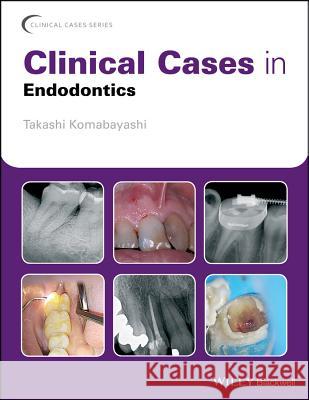 Clinical Cases in Endodontics Takashi Komabayashi 9781119147046 Wiley-Blackwell - książka