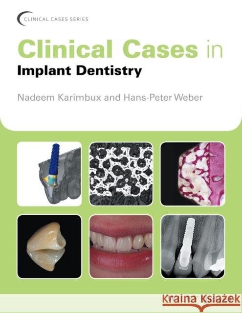 Clinical Cases in Implant Dentistry  9781118702147 John Wiley & Sons - książka