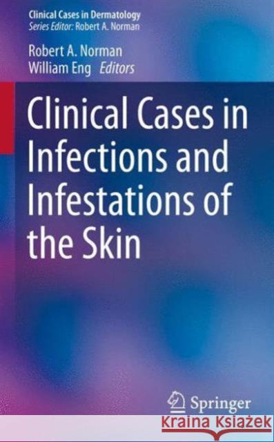 Clinical Cases in Infections and Infestations of the Skin Robert A. Norman William Eng Robert A. Norman 9783319142944 Springer - książka