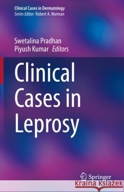 Clinical Cases in Leprosy Swetalina Pradhan Piyush Kumar  9783031082191 Springer International Publishing AG - książka