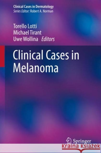 Clinical Cases in Melanoma Torello Lotti Michael Tirant Uwe Wollina 9783030508197 Springer - książka