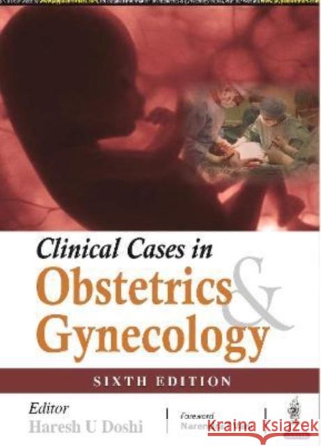 Clinical Cases in Obstetrics & Gynecology Haresh U Doshi 9789390595754 JP Medical Publishers (RJ) - książka