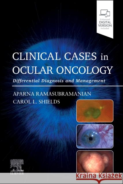 Clinical Cases in Ocular Oncology: Differential Diagnosis and Management Aparna Ramasubramanian Carol L. Shields 9780443120497 Elsevier - książka
