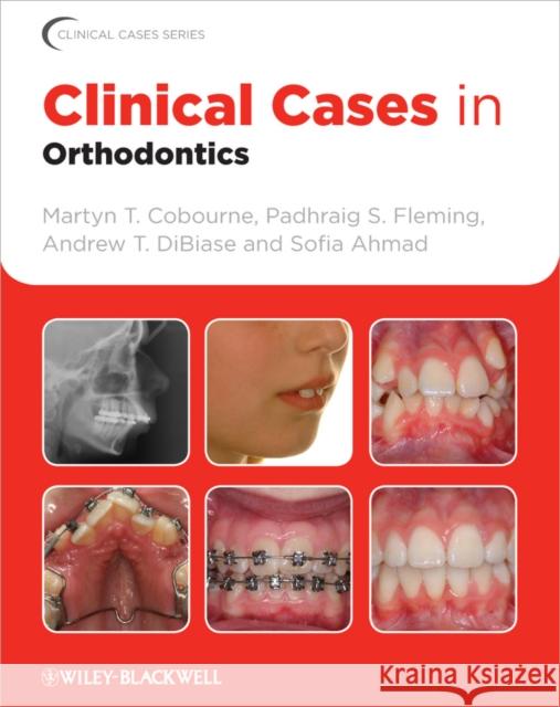 Clinical Cases in Orthodontics Martyn T Cobourne 9781405197793  - książka