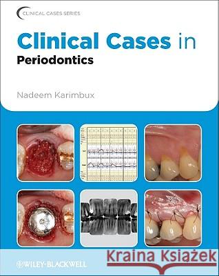 Clinical Cases in Periodontics Karimbux, Nadeem 9780813807942 Clinical Cases - książka