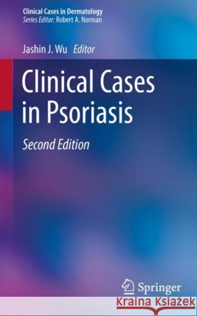 Clinical Cases in Psoriasis Jashin J. Wu 9783030187712 Springer - książka