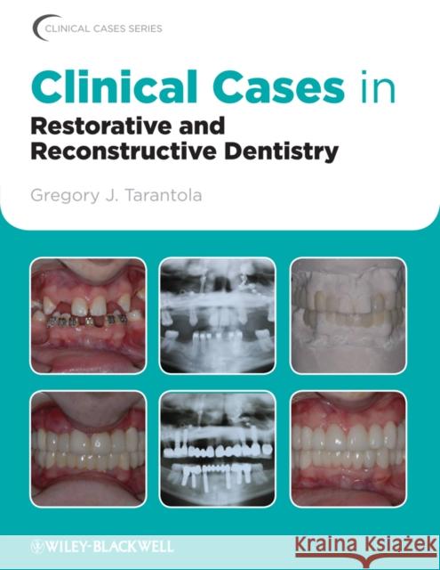 Clinical Cases in Restorative and Reconstructive Dentistry Gregory J Tarantola 9780813815640  - książka