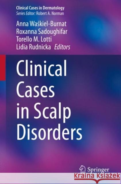 Clinical Cases in Scalp Disorders  9783030934255 Springer International Publishing - książka