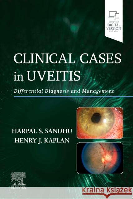 Clinical Cases in Uveitis: Differential Diagnosis and Management Harpal Sandhu Henry J. Kaplan 9780323695411 Elsevier - książka