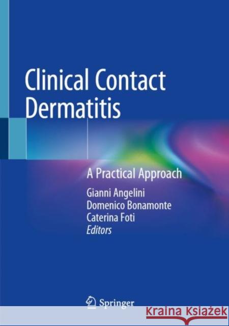 Clinical Contact Dermatitis: A Practical Approach Angelini, Gianni 9783030493318 Springer - książka