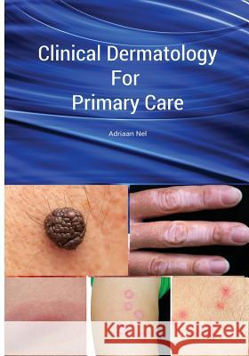 Clinical Dermatology For Primary Care Nel, Adriaan 9781517590376 Createspace - książka