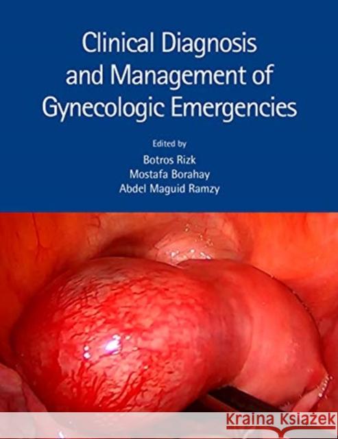 Clinical Diagnosis and Management of Gynecologic Emergencies Botros Rizk Mostafa A Abdel Magui 9780367443146 CRC Press - książka