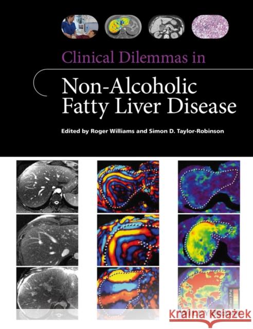 Clinical Dilemmas in Non-Alcoholic Fatty Liver Disease Williams, Roger; Taylor–Robinson, Simon D. 9781118912034 John Wiley & Sons - książka