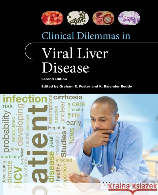 Clinical Dilemmas in Viral Liver Disease K. Rajender Reddy Graham Foster 9781119533399 Wiley-Blackwell - książka