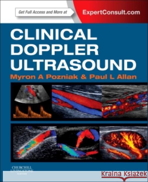 Clinical Doppler Ultrasound Pozniak, Myron A. 9780702050152 Elsevier Churchill Livingstone - książka