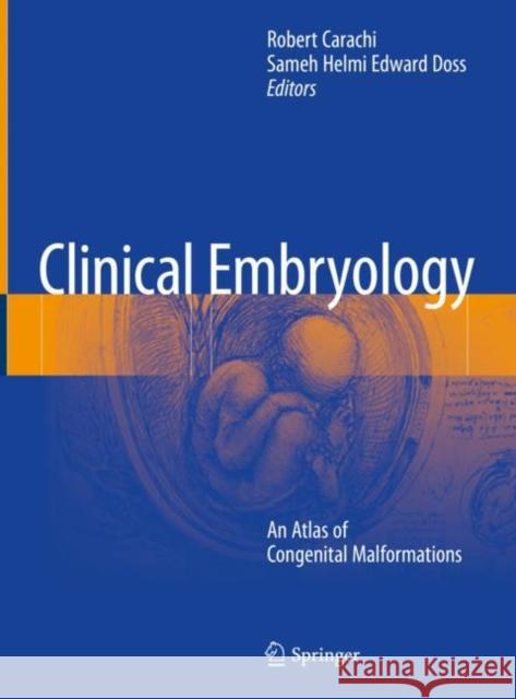 Clinical Embryology: An Atlas of Congenital Malformations Carachi, Robert 9783319261560 Springer - książka