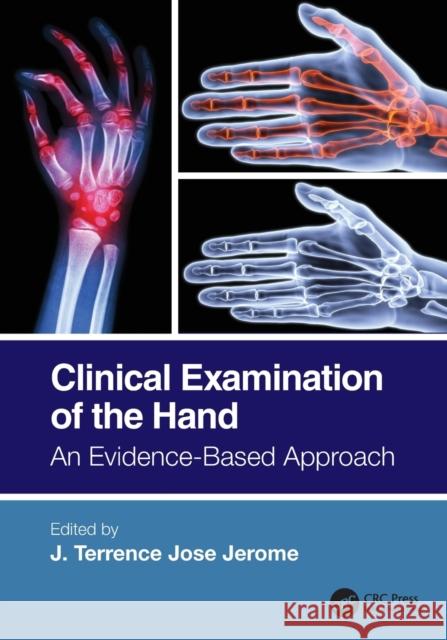 Clinical Examination of the Hand: An Evidence-Based Approach Jerome, J. Terrence Jose 9780367647162 CRC Press - książka