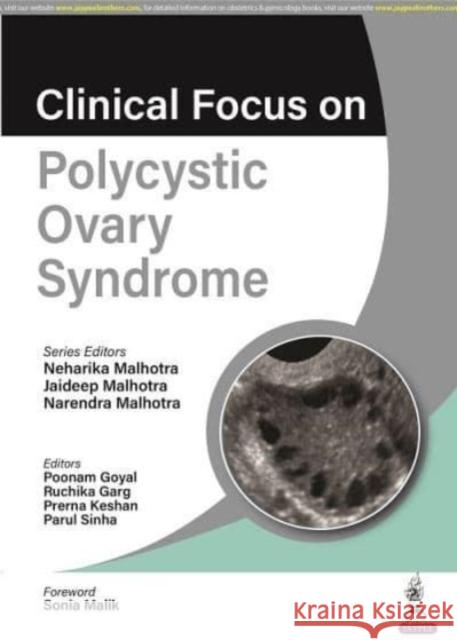 Clinical Focus on Polycystic Ovary Syndrome Neharika Malhotra Jaideep Malhotra Narendra Malhotra 9789356960916 Jaypee Brothers Medical Publishers - książka