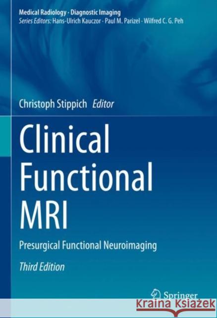 Clinical Functional MRI: Presurgical Functional Neuroimaging Christoph Stippich 9783030833428 Springer - książka