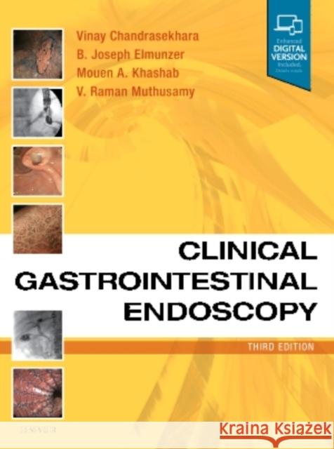 Clinical Gastrointestinal Endoscopy Vinay Chandrasekhara B. Joseph Elmunzer, MD, MSc Mouen Khashab, MD, Dr. 9780323415095 Elsevier - Health Sciences Division - książka