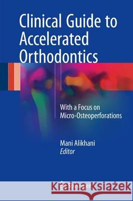 Clinical Guide to Accelerated Orthodontics: With a Focus on Micro-Osteoperforations Alikhani, Mani 9783319433998 Springer - książka