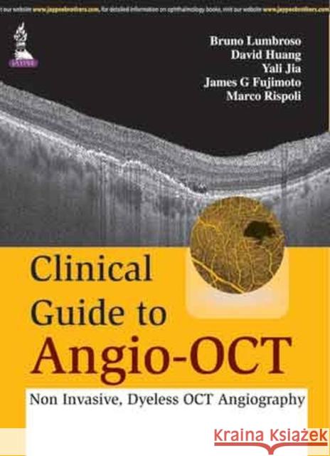 Clinical Guide to Angio-OCT: Non Invasive, Dyeless OCT Angiography  Lumbroso, Bruno|||Huang, David|||Fujimoto, James G. 9789351523994  - książka