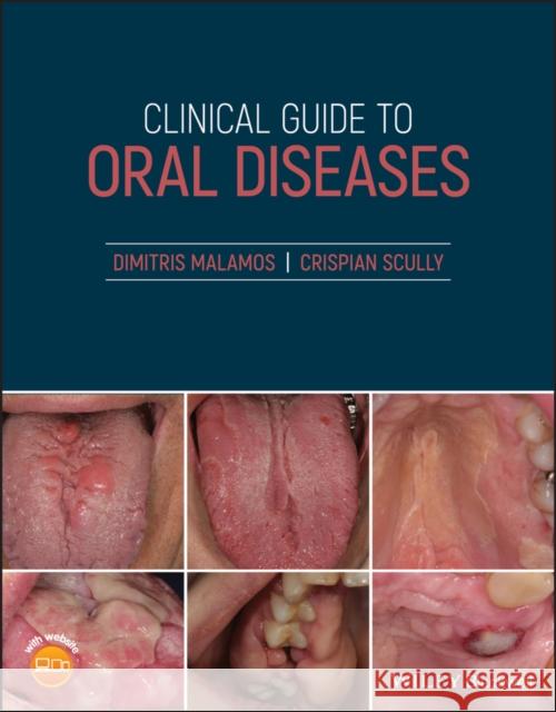 Clinical Guide to Oral Diseases Dimitrios Malamos Crispian Scully, CBE  9781119328117 John Wiley and Sons Ltd - książka