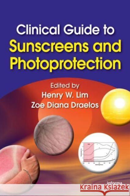 Clinical Guide to Sunscreens and Photoprotection Henry W. Lim Zoe Diana Draelos 9781420080841 Informa Healthcare - książka