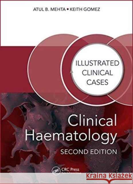 Clinical Haematology: Illustrated Clinical Cases Atul Bhanu Mehta 9781482243796 Apple Academic Press - książka