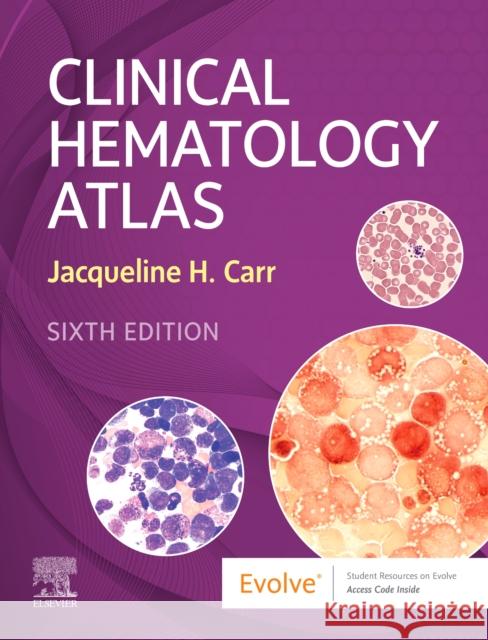 Clinical Hematology Atlas Jacqueline H. Carr 9780323711920 Elsevier - Health Sciences Division - książka