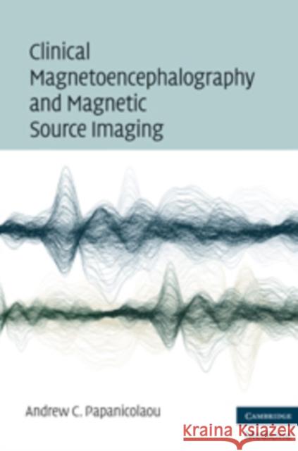 Clinical Magnetoencephalography and Magnetic Source Imaging Andrew C. Papanicolaou 9780521873758 Cambridge University Press - książka
