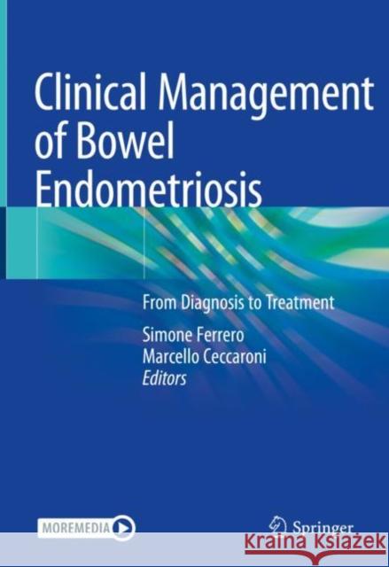 Clinical Management of Bowel Endometriosis: From Diagnosis to Treatment Ferrero, Simone 9783030504458 Springer - książka