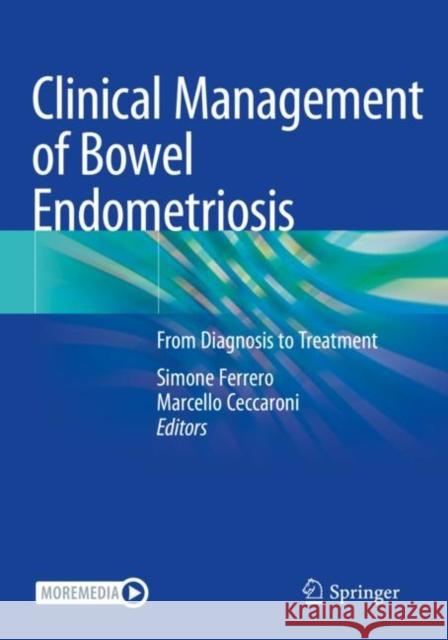 Clinical Management of Bowel Endometriosis: From Diagnosis to Treatment Ferrero, Simone 9783030504489 Springer International Publishing - książka