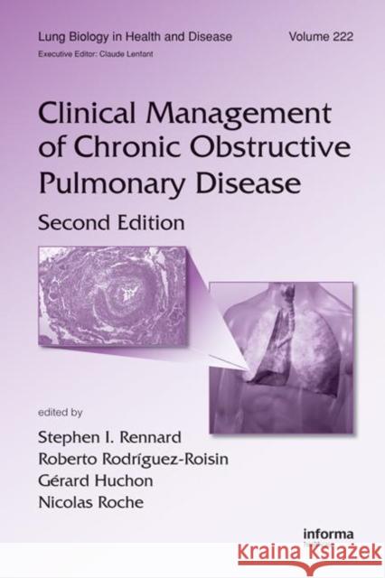 Clinical Management of Chronic Obstructive Pulmonary Disease Stephen I. Rennard Stephen I. Rennard Gerard Huchon 9780849375873 Informa Healthcare - książka