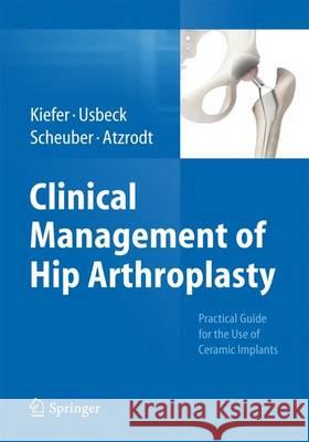 Clinical Management of Hip Arthroplasty: Practical Guide for the Use of Ceramic Implants Kiefer, Hartmuth 9783662454916 Springer - książka