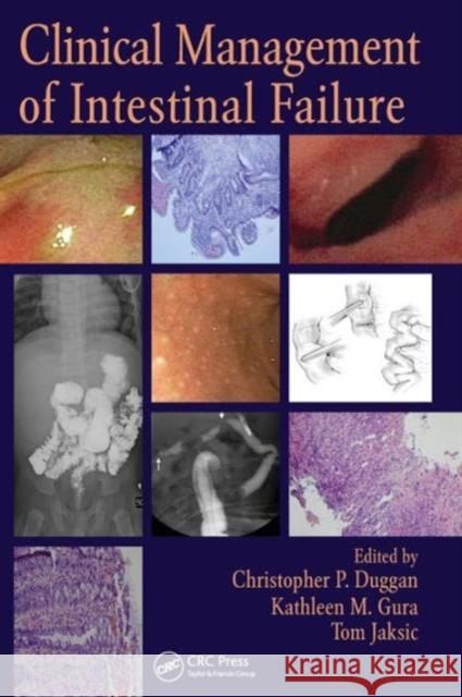 Clinical Management of Intestinal Failure Christopher Duggan Tom Jaksic Kathleen Gura 9781439813904 CRC Press - książka