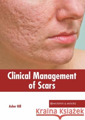 Clinical Management of Scars Asher Hill 9781639871148 Murphy & Moore Publishing - książka