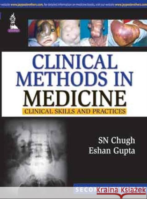 Clinical Methods in Medicine SN Chugh 9789350250396 Jaypee Brothers Medical Publishers - książka