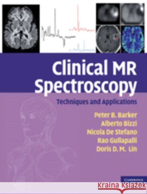 Clinical MR Spectroscopy: Techniques and Applications Barker, Peter B. 9780521868983 Cambridge University Press - książka