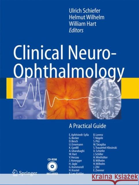 Clinical Neuro-Ophthalmology: A Practical Guide [With DVD-ROM] Schiefer, Ulrich 9783540327066 Springer - książka