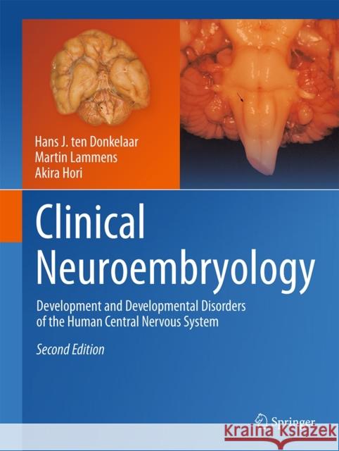 Clinical Neuroembryology: Development and Developmental Disorders of the Human Central Nervous System Ten Donkelaar, Hans J. 9783642546860 Springer - książka