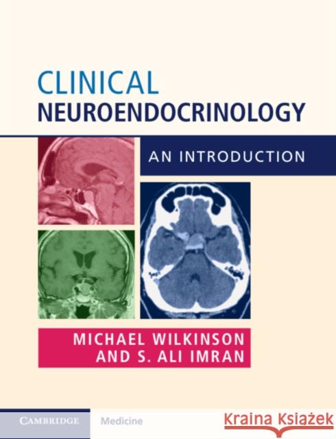 Clinical Neuroendocrinology: An Introduction Michael Wilkinson Ali Imran 9781316645192 Cambridge University Press - książka