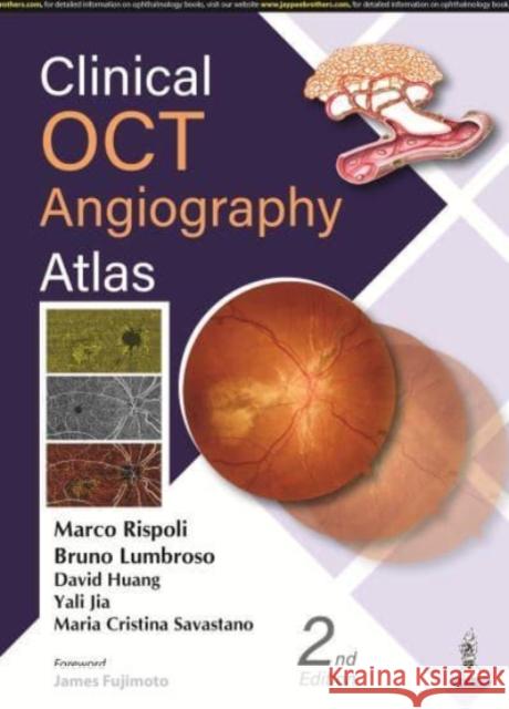 Clinical OCT Angiography Atlas Marco Rispoli Bruno Lumbroso David Huang 9789354655036 Jaypee Brothers Medical Publishers - książka