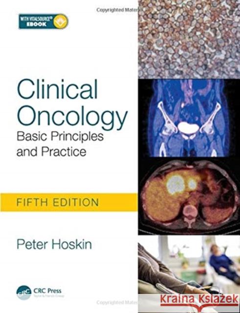 Clinical Oncology: Basic Principles and Practice Hoskin, Peter 9780367896966 CRC Press - książka