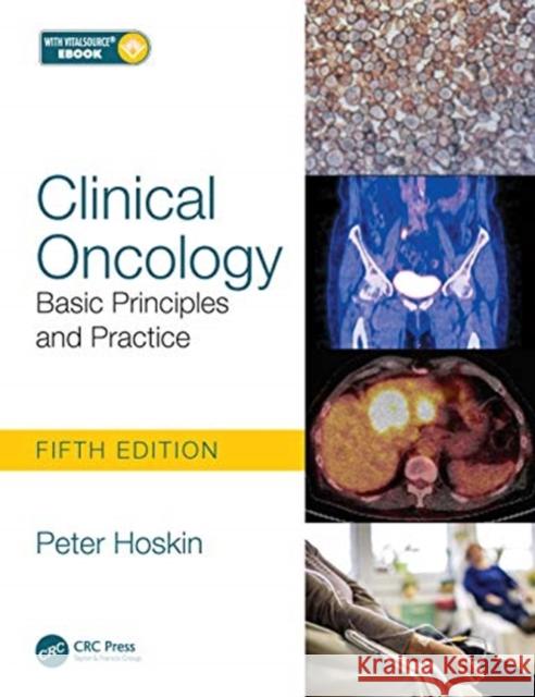 Clinical Oncology: Basic Principles and Practice Peter Hoskin Peter Ostler Robert Glynne-Jones 9781138035553 Taylor & Francis Ltd - książka