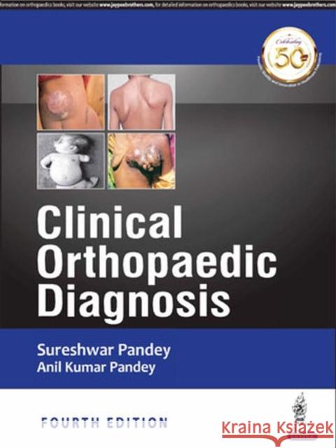 Clinical Orthopedic Diagnosis Sureshwar Pandey Kumar Anil Pandey  9789352705504 Jaypee Brothers Medical Publishers - książka