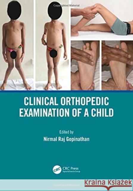 Clinical Orthopedic Examination of a Child Gopinathan, Nirmal Raj 9780367001445 Taylor & Francis Ltd - książka