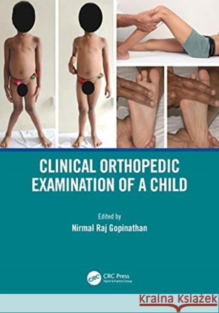 Clinical Orthopedic Examination of a Child Nirmal Raj Gopinathan 9780367722357 CRC Press - książka