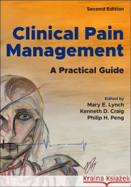 Clinical Pain Management: A Practical Guide Lynch, Mary E. 9781119701156 John Wiley and Sons Ltd - książka