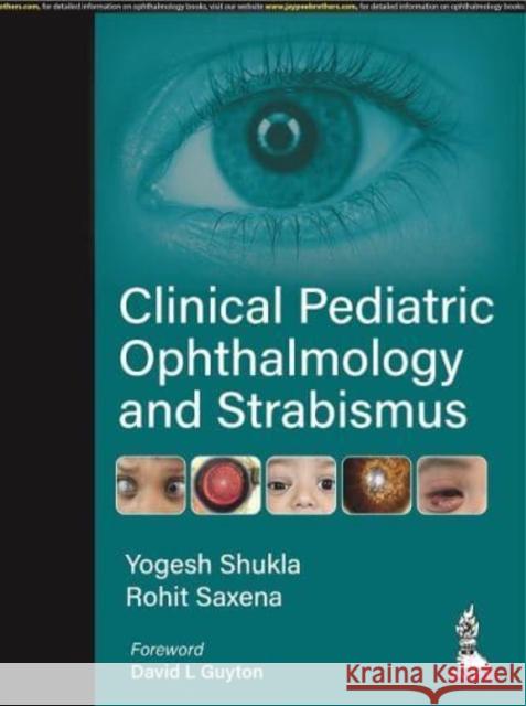 Clinical Pediatric Ophthalmology and Strabismus Yogesh Shukla Richa Saxena  9789354653537 Jaypee Brothers Medical Publishers - książka